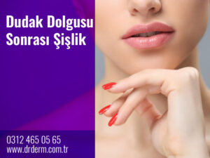 Dudak Dolgusu Sonrası Şişlik