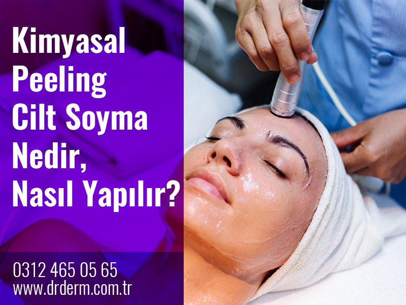 Kimyasal Peeling Cilt Soyma Nedir, Nasıl Yapılır?