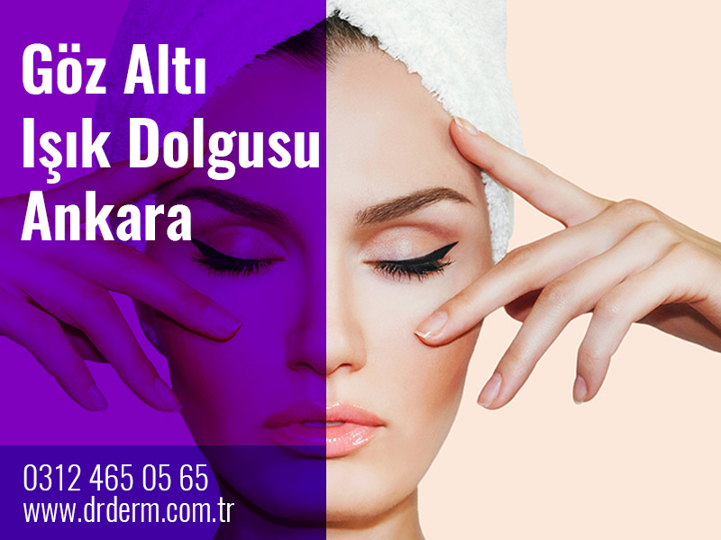 Göz Altı Işık Dolgusu Ankara