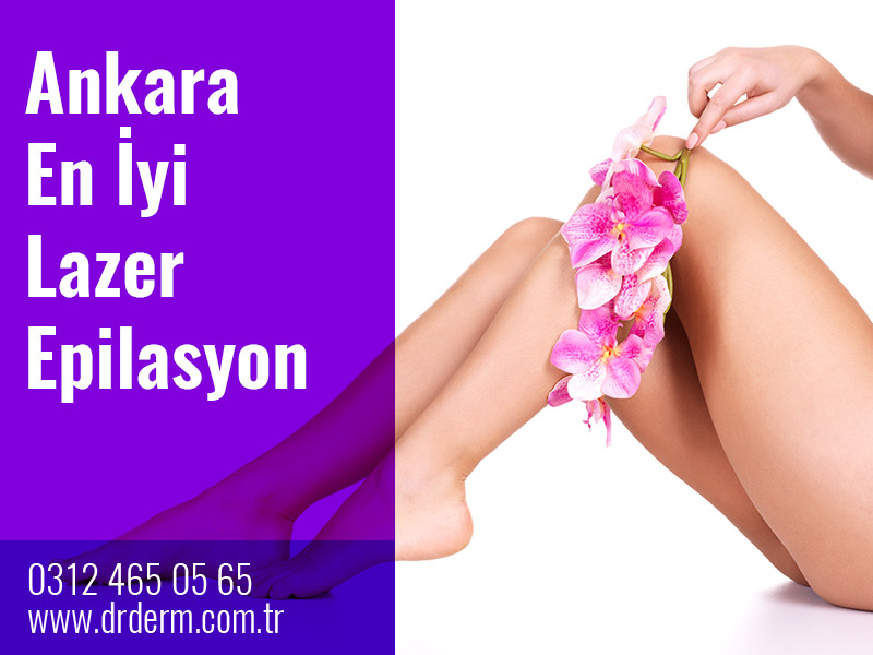 Ankara En İyi Lazer Epilasyon