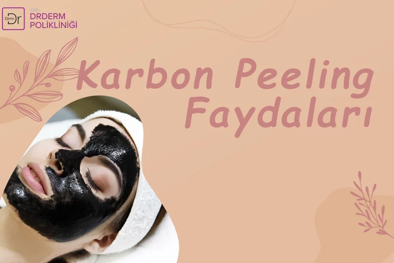 Karbon Peeling Faydaları
